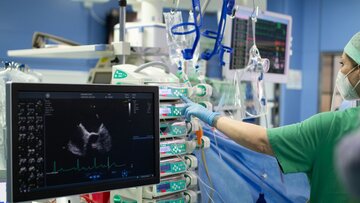 Monitor zeigt Ultraschallaufnahme während Operation.