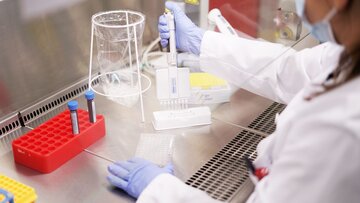 Laborantin überprüft Blutproben